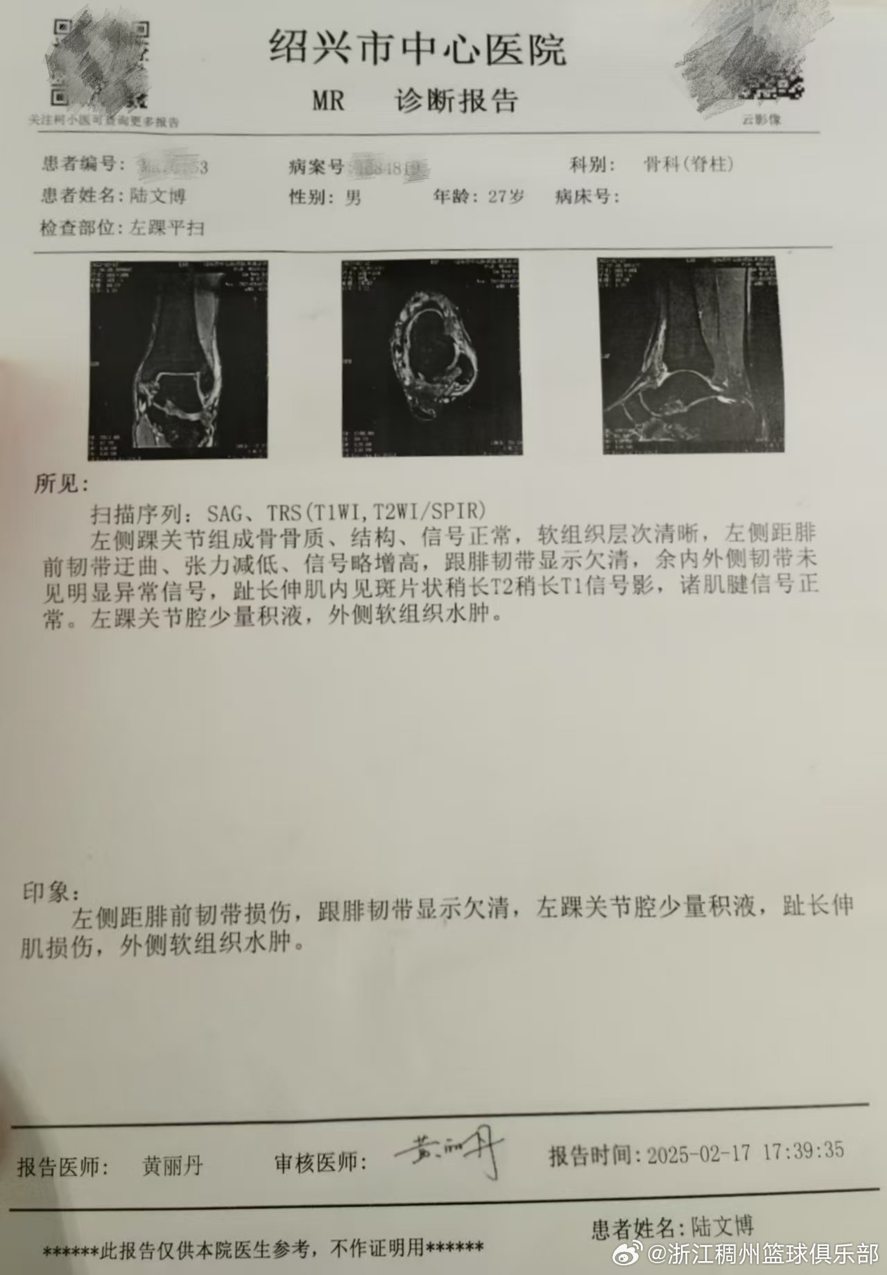 的U